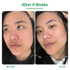 Birch Babe Lighten, Tighten, Brighten (LTB)｜3 Step Skincare 套裝 產品細節圖 15